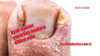 Tırnak mantarı, tırnakları sararak kötü bir duruma dönüşebilir. Bu sorun